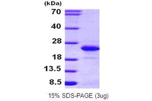 SDS-PAGE (SDS) image for Fibroblast Growth Factor 12 (FGF12) (AA 1-181) protein (His tag) (ABIN666721)