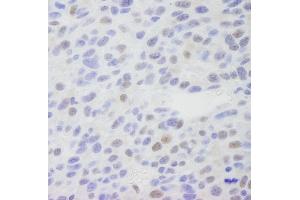 Immunohistochemistry (IHC) image for anti-Mediator Complex Subunit 1 (MED1) (C-Term) antibody (ABIN7448659) (MED1 antibody  (C-Term))