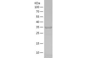 Western Blotting (WB) image for N-Acetylgalactosaminidase, alpha (NAGA) (AA 210-321) protein (His-IF2DI Tag) (ABIN7282516) (NAGA Protein (AA 210-321) (His-IF2DI Tag))