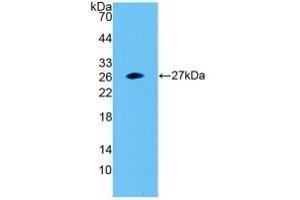Detection of Recombinant SNAP23, Human using Polyclonal Antibody to Synaptosomal Associated Protein 23 kDa (SNAP23) (SNAP23 antibody  (AA 1-211))