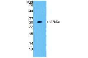 Detection of Recombinant SNAP23, Human using Polyclonal Antibody to Synaptosomal Associated Protein 23 kDa (SNAP23)