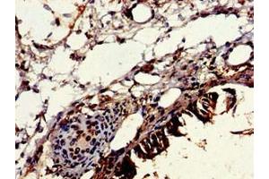 Immunohistochemistry of paraffin-embedded human lung tissue using ABIN7175666 at dilution of 1:100