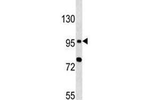 TLR6 antibody western blot analysis in MCF-7 lysate (TLR6 antibody  (AA 1-30))