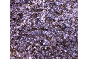 IHC analysis of IL7 using anti-IL7 antibody (ABIN3044526). (IL-7 antibody  (AA 26-154))