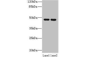 Western blot All lanes: ZDHHC6 antibody at 0. (ZDHHC6 antibody  (AA 227-409))