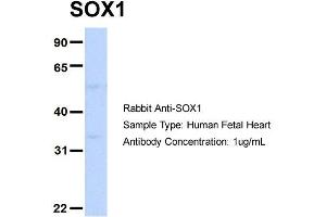 Host: Rabbit Target Name: SOX1 Sample Type: Human Fetal Heart Antibody Dilution: 1. (SOX1 antibody  (Middle Region))