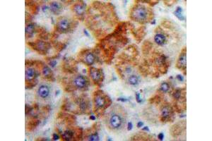 IHC-P analysis of Liver tissue, with DAB staining. (Orosomucoid 2 antibody  (AA 19-207))