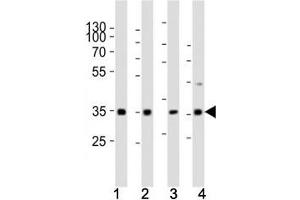 Western blot analysis of lysate from (1) human HeLa cell line, (2) mouse spleen, (3) rat lung, (4) rat stomach tissue using Cyclin D3 antibody at 1:1000. (Cyclin D3 antibody  (AA 33-66))