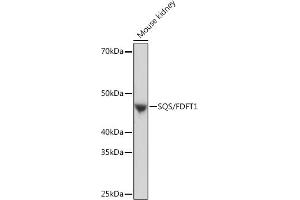Western blot analysis of extracts of Mouse kidney, using SQS/FDFT1 Rabbit mAb (ABIN7267130) at 1:1000 dilution.