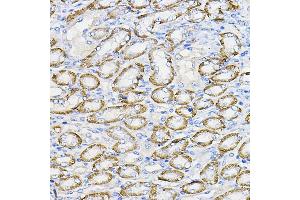 Immunohistochemistry of paraffin-embedded mouse kidney using NUBP1 Rabbit pAb (ABIN7269062) at dilution of 1:100 (40x lens). (NUBP1 antibody  (AA 201-320))
