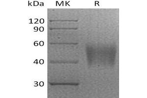Western Blotting (WB) image for V-Set Domain Containing T Cell Activation Inhibitor 1 (VTCN1) (Active) protein (His tag) (ABIN7321009) (VTCN1 Protein (His tag))