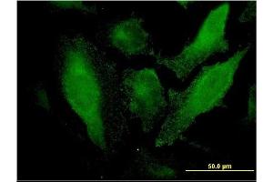 Immunofluorescence of monoclonal antibody to SRCRB4D on HeLa cell. (SRCRB4D antibody  (AA 1-190))