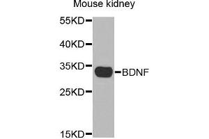 Western Blotting (WB) image for anti-Brain-Derived Neurotrophic Factor (BDNF) (AA 20-247) antibody (ABIN3021893) (BDNF antibody  (AA 20-247))