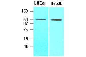 Cell lysates of Lnitrocelluloseap, Hep3B (30 ug) were resolved by SDS-PAGE, transferred to nitrocellulose membrane and probed with anti-human ACOT11 (1:1000). (ACOT11 antibody  (AA 19-250))