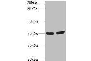 Western blot All lanes: OSR2 antibody at 7 μg/mL Lane 1: Jurkat whole cell lysate Lane 2: Hela whole cell lysate Secondary Goat polyclonal to rabbit IgG at 1/10000 dilution Predicted band size: 36, 31, 49 kDa Observed band size: 36 kDa