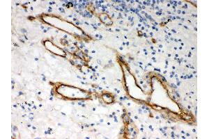 Immunohistochemistry (Paraffin-embedded Sections) (IHC (p)) image for anti-Heparan Sulfate Proteoglycan 2 (HSPG2) (AA 524-701) antibody (ABIN3042466) (HSPG2 antibody  (AA 524-701))