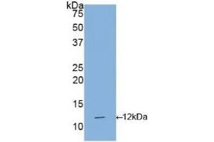 Detection of Recombinant IL1R1, Human using Polyclonal Antibody to Interleukin 1 Receptor Type I (IL1R1) (IL1R1 antibody  (AA 21-109))