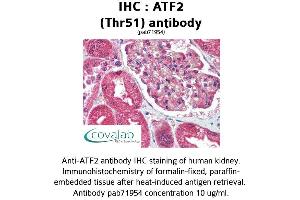 Image no. 1 for anti-Activating Transcription Factor 2 (ATF2) antibody (ABIN1732006) (ATF2 antibody)