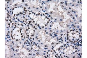 Immunohistochemical staining of paraffin-embedded endometrium tissue using anti-TTLL12mouse monoclonal antibody. (TTLL12 antibody)