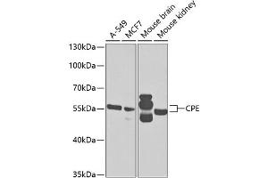 Western blot analysis of extracts of various cell lines, using CPE antibody (ABIN6127655, ABIN6138943, ABIN6138944 and ABIN6221116) at 1:1000 dilution. (CPE antibody  (AA 257-476))