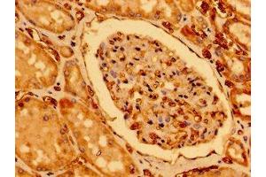 Immunohistochemistry of paraffin-embedded human kidney tissue using ABIN7147612 at dilution of 1:100 (CHDH antibody  (AA 30-223))