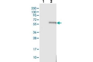 Western blot analysis of Lane 1: Negative control (vector only transfected HEK293T lysate), Lane 2: Over-expression Lysate (Co-expressed with a C-terminal myc-DDK tag (~3. (TSTD2 antibody)