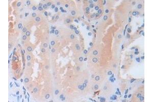 Immunohistochemistry (IHC) image for anti-serpin Peptidase Inhibitor, Clade B (Ovalbumin), Member 9 (SERPINB9) (AA 1-376) antibody (ABIN7435502)