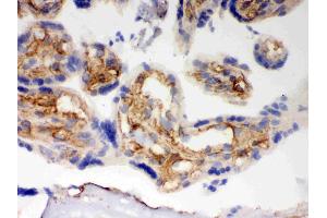 Immunohistochemistry (IHC) image for anti-BCL2-Antagonist/killer 1 (BAK1) (AA 22-211) antibody (ABIN3042342)