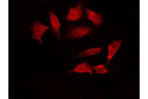 Immunofluorescence (fixed cells) (IF/ICC) image for anti-Checkpoint Kinase 1 (CHEK1) (pSer286) antibody (ABIN6255167)