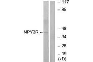Western blot analysis of extracts from HepG2 cells, using NPY2R Antibody. (NPY2R antibody  (AA 1-50))