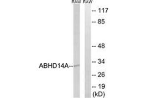 Western blot analysis of extracts from RAW264. (ABHD14A antibody  (AA 201-250))