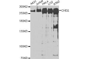 Western blot analysis of extracts of various cell lines, using CHD2 antibody. (CHD2 antibody  (C-Term))