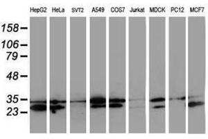 Image no. 4 for anti-Haloacid Dehalogenase-Like Hydrolase Domain Containing 1 (HDHD1) antibody (ABIN1498623)