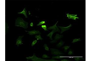 Immunofluorescence of monoclonal antibody to NTRK3 on HeLa cell. (NTRK3 antibody  (AA 41-160))