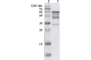 Western Blot testing of anti-HCV NS5B protein using chimeric anti-HCV NS5B antibody 9A2. (HCV 1b NS5B antibody  (AA 111-130))