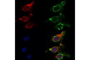 ABIN6262617 and ABIN6268893 staining HepG2 by IF/ICC. (Integrin beta 4 antibody  (C-Term))