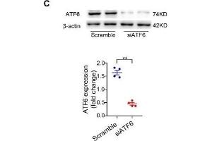 BCAA increase PPAR-α expression in a GCN2/ATF6 pathway-dependent manner.