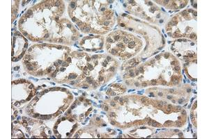 Image no. 1 for anti-Transforming, Acidic Coiled-Coil Containing Protein 3 (TACC3) antibody (ABIN1498098) (TACC3 antibody)