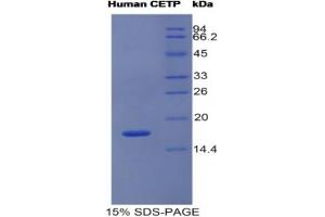 SDS-PAGE analysis of Human CETP Protein. (CETP Protein)
