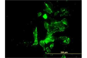 Immunofluorescence of monoclonal antibody to CENPK on HepG2 cell. (CENPK antibody  (AA 1-269))