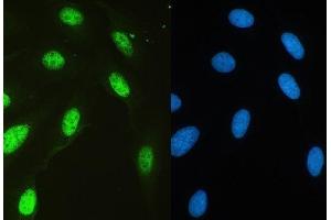 IF analysis of HAUSP/USP7 using anti-HAUSP/USP7 antibody (ABIN5693267). (USP7 antibody  (AA 258-483))