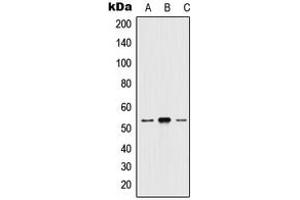 Western blot analysis of 5-HT2A expression in HEK293T (A), mouse brain (B), H9C2 (C) whole cell lysates.