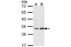 WB Image Sample (30 ug of whole cell lysate) A: Hela B: Hep G2 , 12% SDS PAGE antibody diluted at 1:1000 (PMM2 antibody)