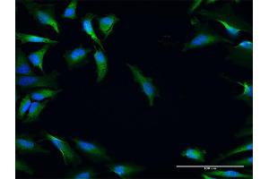 Immunofluorescence of purified MaxPab antibody to NRBF2 on HeLa cell.