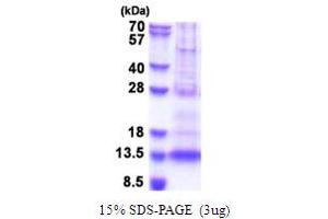 SDS-PAGE (SDS) image for Platelet Factor 4 Variant 1 (PF4V1) (AA 31-104) protein (His tag) (ABIN5853671)