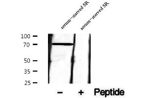 Western blot analysis of extracts of serum-starved SR cells, using Phospho-Syk (Ser297) Antibody.