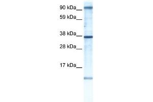AKAP7 antibody used at 1 ug/ml to detect target protein. (AKAP7 antibody)