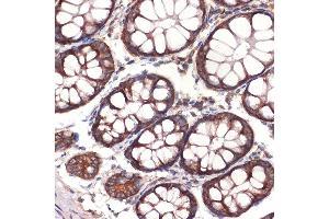 Immunohistochemistry of paraffin-embedded human colon using CC2D1A Rabbit mAb (ABIN7266430) at dilution of 1:100 (40x lens). (CC2D1A antibody)