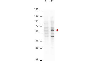 Western Blotting (WB) image for anti-V-Akt Murine Thymoma Viral Oncogene Homolog 1 (AKT1) (Thr308) antibody (ABIN400786) (AKT1 antibody  (Thr308))