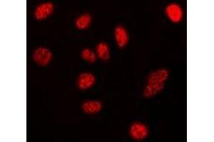 Immunofluorescence (IF) image for anti-Nucleophosmin (Nucleolar phosphoprotein B23, Numatrin) (NPM1) (C-Term) antibody (ABIN7304024)